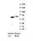 CCT8 antibody - C-terminal region